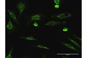 Immunofluorescence of purified MaxPab antibody to ECHS1 on HeLa cell. (ECHS1 Antikörper  (AA 1-290))