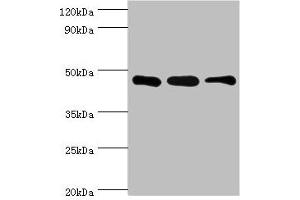 Western blot All lanes: SUGCT antibody at 16 μg/mL Lane 1: Mouse skeletal muscle tissue Lane 2: Mouse liver tissue Lane 3: Mouse kidney tissue Secondary Goat polyclonal to rabbit IgG at 1/10000 dilution Predicted band size: 49, 48, 52, 44 kDa Observed band size: 42 kDa (SUGCT Antikörper  (AA 1-250))