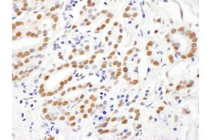 Immunohistochemistry (IHC) image for anti-Ring Finger Protein 1 (RING1) (AA 150-200) antibody (ABIN7454929)