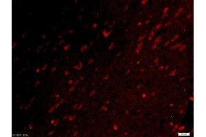 Paraformaldehyde-fixed, paraffin embedded rat brain tissue, Antigen retrieval by boiling in sodium citrate buffer(pH6) for 15min, Block endogenous peroxidase by 3% hydrogen peroxide for 30 minutes, Blocking buffer (normal goat serum) at 37°C for 20min, Antibody incubation with Rabbit Anti-UBE2Q1 Polyclonal Antibody, Unconjugated  at 1:500 overnight at 4°C, followed by a conjugated secondary and DAPI staining (UBE2Q1 Antikörper  (AA 321-422))