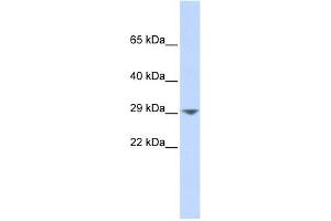 KCNN2 antibody used at 1 ug/ml to detect target protein.