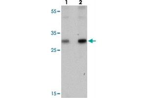 Western blot analysis of PTRF in human spleen tissue with PTRF polyclonal antibody  at (lane 1) 0. (PTRF Antikörper  (C-Term))