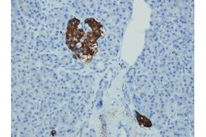 Immunohistochemistry (IHC) image for anti-Synaptophysin (SYP) (AA 293-310), (C-Term) antibody (ABIN7598775) (Synaptophysin Antikörper  (C-Term))