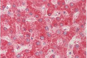 ABIN1590061 (5µg/ml) staining of paraffin embedded Human Liver. (MMP14 Antikörper  (Internal Region))
