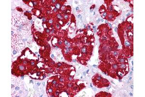 Immunohistochemistry (IHC) image for anti-Nuclear Receptor Subfamily 4, Group A, Member 2 (NR4A2) (N-Term) antibody (ABIN6745718)