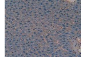 Figure. (Versican Antikörper  (AA 3058-3299))