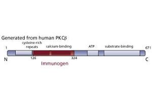 Image no. 2 for anti-Protein Kinase C, beta (PRKCB) (AA 126-324) antibody (ABIN967769) (PKC beta Antikörper  (AA 126-324))