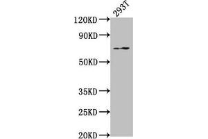 Western Blot Positive WB detected in: 293T whole cell lysate All lanes: PXN antibody at 1:2000 Secondary Goat polyclonal to rabbit IgG at 1/50000 dilution Predicted band size: 65, 61, 67, 47 kDa Observed band size: 65 kDa (Paxillin Antikörper  (AA 28-45))