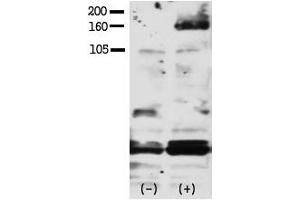 Image no. 1 for anti-V-Erb-A erythroblastic Leukemia Viral Oncogene Homolog 4 (Avian) (ERBB4) (pTyr1188) antibody (ABIN358140) (ERBB4 Antikörper  (pTyr1188))