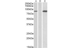 HEK293 lysate (10ug protein in RIPA buffer) overexpressing Human STAT4 (RC206892) with C-terminal MYC tag probed with ABIN571127 (0. (STAT4 Antikörper  (AA 613-627))