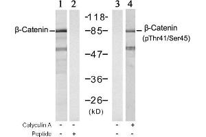 Image no. 1 for anti-Catenin (Cadherin-Associated Protein), beta 1, 88kDa (CTNNB1) (pSer45), (pThr41) antibody (ABIN196815) (CTNNB1 Antikörper  (pSer45, pThr41))