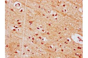 IHC image of ABIN7154356 diluted at 1:500 and staining in paraffin-embedded human brain tissue performed on a Leica BondTM system. (PIGT Antikörper  (AA 402-562))