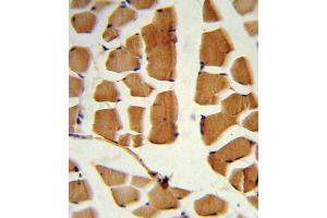Immunohistochemistry (IHC) image for anti-BMI1 Polycomb Ring Finger Oncogene (BMI1) antibody (ABIN3001536) (BMI1 Antikörper)