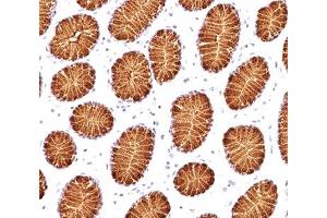 IHC testing of human stomach stained with MUC5AC antibody (45M1). (MUC5AC Antikörper)