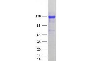 Validation with Western Blot (AP1B1 Protein (Transcript Variant 1) (Myc-DYKDDDDK Tag))