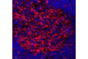 Immunofluorescence of paraffin embedded rat lymph node using SLBP (ABIN7075733) at dilution of 1: 650 (400x lens)