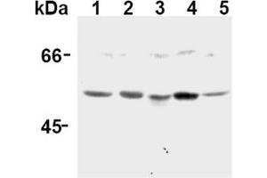 Western Blotting (WB) image for anti-Caspase 12 (Gene/pseudogene) (CASP12) (AA 95-318), (N-Term) antibody (ABIN567795) (Caspase 12 Antikörper  (N-Term))
