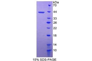 SDS-PAGE (SDS) image for Melanoma Inhibitory Activity (MIA) (AA 36-127) protein (His tag,GST tag) (ABIN2123252) (MIA Protein (AA 36-127) (His tag,GST tag))