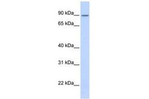 Image no. 1 for anti-Zinc Finger Protein 408 (ZNF408) (AA 576-625) antibody (ABIN6740345) (ZNF408 Antikörper  (AA 576-625))