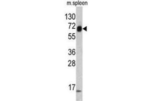 Western blot analysis of KRT4 antibody (C-term) in mouse spleen tissue lysates (35ug/lane).