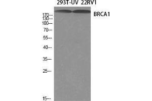 Western Blot (WB) analysis of specific cells using BRCA1 Polyclonal Antibody. (BRCA1 Antikörper  (Ser184, Ser186))