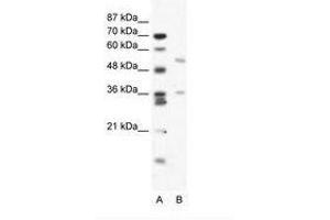 Image no. 1 for anti-BTB (POZ) Domain Containing 3 (BTBD3) (AA 349-398) antibody (ABIN203194)