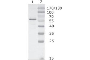 Western-Blot analysis of HIV-1 HAN subtype gag protein using HIV-1 p24 (05-001) antibody. (Human Immunodeficiency Virus Type 1 (HIV-1) Antikörper)