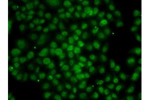 Immunofluorescence analysis of MCF-7 cells using ATMIN antibody (ABIN4902975). (ATM Interactor Antikörper)