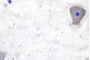 Immunohistochemistry analyzes of GAS3 antibody in paraffin-embedded human brain tissue. (PMP22 Antikörper)