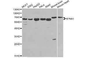 Western blot analysis of extracts of various cell lines, using KPNA1 antibody. (KPNA1 Antikörper  (AA 1-300))