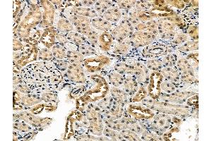 ABIN7093243 and ABIN7097260 at 1/100 staining Rat kidney tissue by IHC-P. (IRF7 Antikörper  (pSer479))