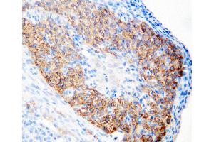 Anti-hCG receptor antibody, IHC(P) IHC(P): Rat Ovary Tissue (LHCGR Antikörper  (N-Term))
