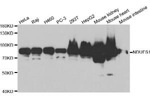 Western blot analysis of extracts of various cell lines, using NDUFS1 antibody (ABIN5971414) at 1/1000 dilution. (NDUFS1 Antikörper)