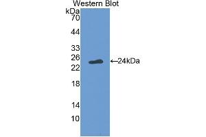Detection of Recombinant FASL, Simian using Polyclonal Antibody to Factor Related Apoptosis Ligand (FASL) (FASL Antikörper  (AA 102-280))