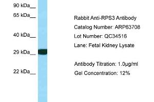 Western Blotting (WB) image for anti-Ribosomal Protein S3 (RPS3) (C-Term) antibody (ABIN2789596) (RPS3 Antikörper  (C-Term))