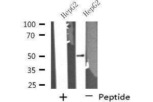 Western blot analysis of extracts from HepG2 cells using PPP4R1L antibody. (PPP4R1L Antikörper)