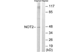 Western blot analysis of extracts from HepG2 cells, treated with starved (24hours), using CNOT2 (epitope around residue 101) antibody.