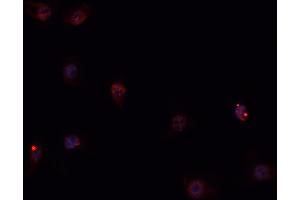 ABIN6269258 staining Hep G2 cells by IF/ICC. (GATA4 Antikörper  (Internal Region))