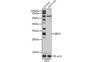 Western blot analysis of extracts of 293T cells, using SIRT5 antibody (ABIN6129331, ABIN6147798, ABIN6147799 and ABIN6221468) at 1:1000 dilution. (SIRT5 Antikörper  (AA 1-310))