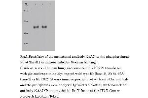 Western Blotting (WB) image for anti-Retinoblastoma 1 (RB1) (pThr821) antibody (ABIN3201013) (Retinoblastoma 1 Antikörper  (pThr821))