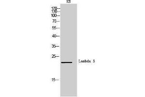 Western Blotting (WB) image for anti-Immunoglobulin lambda-Like Polypeptide 1 (IGLL1) (Internal Region) antibody (ABIN3181479) (IGLL1 Antikörper  (Internal Region))