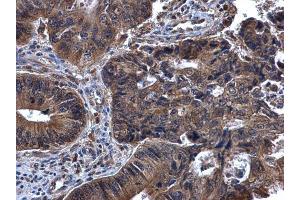 Immunohistochemistry (IHC) image for anti-Spleen tyrosine Kinase (SYK) (Internal Region) antibody (ABIN2854855)