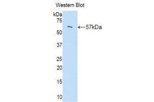 Western Blotting (WB) image for anti-Peptidase Inhibitor 16 (PI16) (AA 21-468) antibody (ABIN1171815)