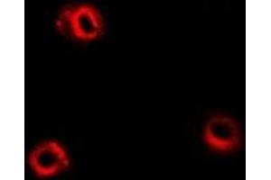 Immunofluorescent analysis of APEH staining in Hela cells. (APEH Antikörper)
