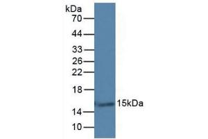 Western Blotting (WB) image for Galectin 7 (LGALS7) ELISA Kit (ABIN6720559)