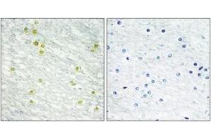 Immunohistochemistry (IHC) image for anti-Mediator Complex Subunit 14 (MED14) (AA 701-750) antibody (ABIN2889330) (MED14 Antikörper  (AA 701-750))