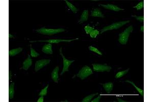 Immunofluorescence of purified MaxPab antibody to PSME3 on HeLa cell. (PSME3 Antikörper  (AA 1-254))