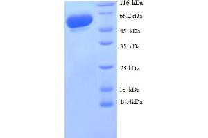 SDS-PAGE (SDS) image for Glyceraldehyde-3-Phosphate Dehydrogenase (G3P) (AA 3-335), (partial) protein (GST tag) (ABIN5712025)