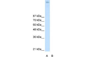 WB Suggested Anti-ZBTB38 Antibody Titration:  2. (ZBTB38 Antikörper  (N-Term))
