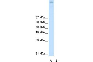 ZBTB38 Antikörper  (N-Term)